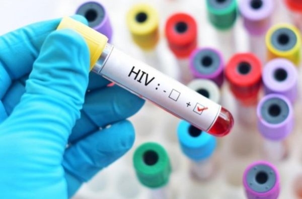 Tìm hiểu về xét nghiệm HIV - Điều Trị HIV